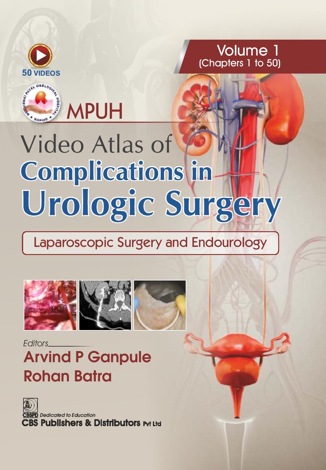 Mpuh video atlas of complications in urologic surgery, volume 1 laparoscopic surgery and endourology